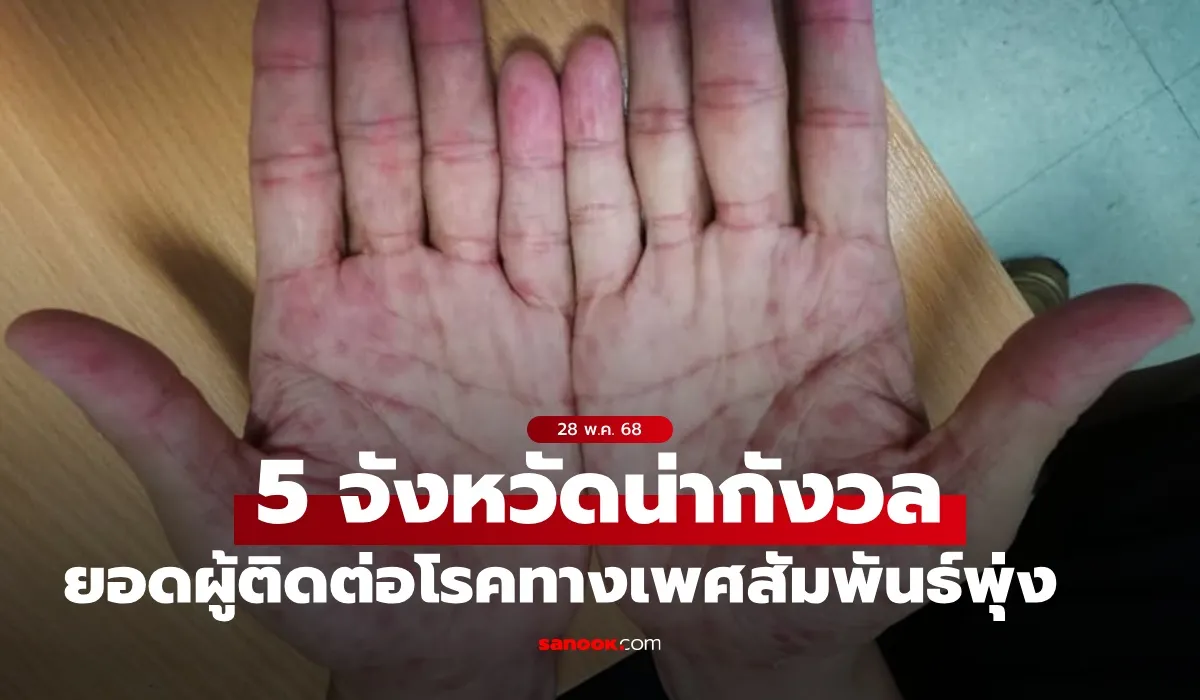 ซิฟิลิส กองโรคเอดส์ เปิดรายชื่อ 5 จังหวัดน่ากังวล โรคติดต่อ